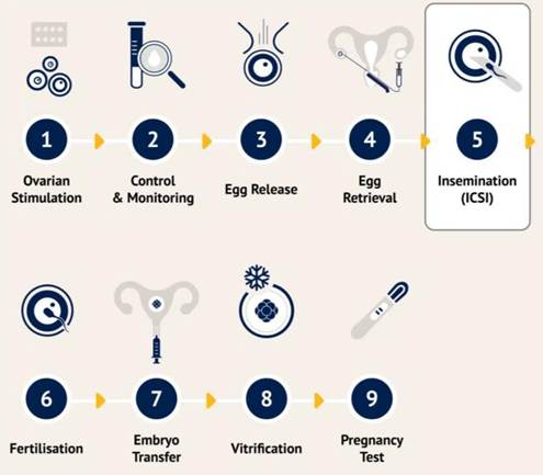 Intracytoplasmic Sperm Injection (ICSI): A Detailed Overview